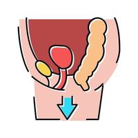 illustrazione vettoriale dell'icona del colore della malattia del prolasso d'organo