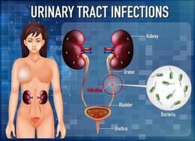 poster informativo sulle infezioni del tratto urinario vettore