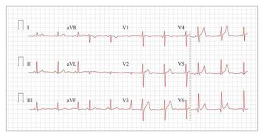 cuore cardiogramma grafico vettore. vettore