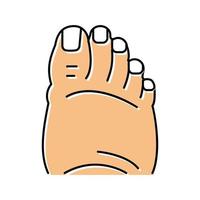 illustrazione vettoriale dell'icona del colore dell'edema del piede grasso
