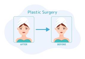 plastica chirurgia piatto cartone animato mano disegnato modelli illustrazione di medico chirurgico operazione su il corpo o viso come previsto utilizzando Avanzate attrezzatura vettore
