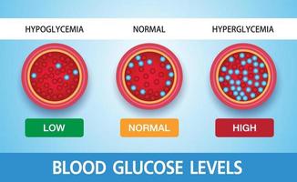 iperglicemia, glicemia alta e diabete, l'obesità è una grave causa di condizioni mediche, disegno vettoriale. vettore