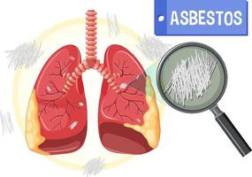 diagramma che mostra l'asbestosi nei polmoni vettore