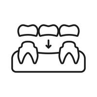 dentale ponte linea icona. ortodontico denti impiantare lineare pittogramma. orale cura. stomatologia protesi. odontoiatria schema simbolo. dentale trattamento cartello. modificabile ictus. isolato vettore illustrazione.