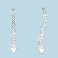 umano colonna vertebrale nel normale e con scoliosi vettore