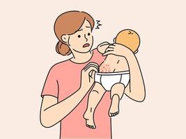 ansioso giovane madre confuso con neonato bambino corpo eruzione cutanea. preoccupato mamma impaurito di bambino infantile pelle allergia. maternità, fanteria assistenza sanitaria. vettore illustrazione.