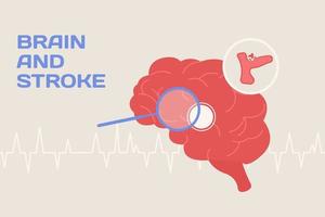 cervello e ictus concetto illustrazione e manifesto nel piatto stile vettore