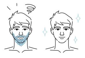 Uomini barba capelli rimozione prima e dopo, bellezza corpo cura concetto con rasoio. vettore design illustrazione.