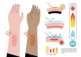 Illustrazione piana di vettore di elementi ultravioletti di Infographic