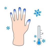 congelamento. mano con congelamento sintomi. effetto di freddo su umano dita. vettore