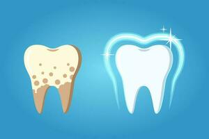 differenza fra trattati denti e denti con placca vettore