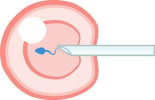 ivf icsi vettore illustrazione. Perfetto per presentazione nulla di riproduzione, inseminazione o fecondazione in vitro