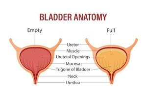 pieno e vuoto Vescica urinaria. urinario Vescica urinaria con urina. anatomia di il umano organo. medicinale, assistenza sanitaria e scienza. infografica bandiera vettore