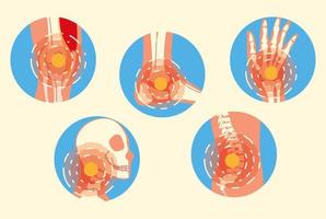 dolori articolari da artrite vettore