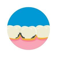 dentale placca vettore illustrazione. mal di denti icona cartello simbolo