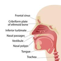 longitudinale sezione di il diagramma di il anatomia di il umano naso. polipi di il naso vettore