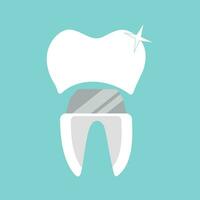 ceppo e corona per dente vettore