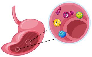 Molti virus nello stomaco umano vettore