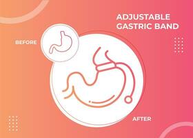illustrazione di regolabile gastrico gruppo musicale escogitare peso perdita chirurgia vettore