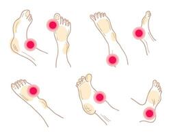 doloroso piedi e gambe con dolore marchio collezione. muscolo dolore, medico e medicina concetto. vettore