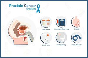 vettore medico illustrazione nel piatto stile, prostata cancro concetto.prostata cancro sintomi.problemi urinare, ossa dolore, peso perdita, sangue nel urina e sperma, erettile disfunzione.piatto stile.