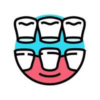 impiallacciature dentale procedura colore icona vettore illustrazione