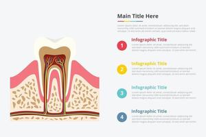 infografica sulla struttura del dente con qualche punto vettore