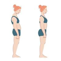 vista laterale di una donna prima e dopo la correzione della postura