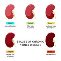 stadi di cronico rene patologia. Infografica concetto vettore illustrazione problema nel urinario sistema e normale rene