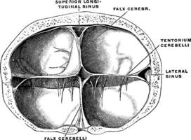 Dura di il cervello, Vintage ▾ illustrazione vettore