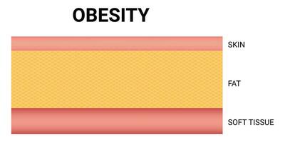 obesità scienza design vettore illustrazione