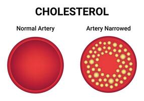 colesterolo normale arteria ristretto arteria scienza design vettore illustrazione diagramma