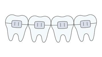 denti riga con bretelle vettore