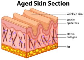 Diagramma di sezione della pelle invecchiata vettore