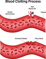 sangue coagulazione processi illustrazione vettore
