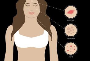 illustrazione di eczema, acne e melasma con donna su nero sfondo vettore