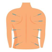 illustrazione mostrando agopuntura aghi su umano indietro per alternativa medicina vettore