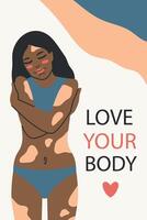 giovane nero ragazza con vitiligine. amore il tuo corpo concetto. moderno illustrazione vettore