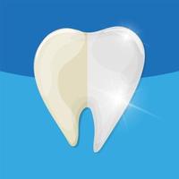 sbiancamento professionale dei denti, dente sano e giallo, illustrazione vettoriale