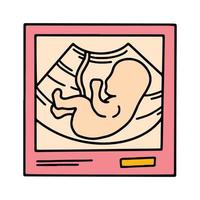 immagine ecografica con un bambino embrione, icona rosa isolata scansione gravidanza in stile cartone animato vettore