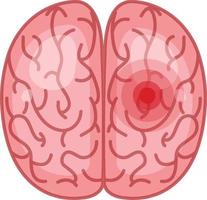 il cervello ha un segnale rosso su sfondo bianco vettore