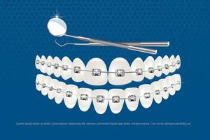 parentesi graffe sui denti. il concetto di correzione del morso. background per una clinica che fornisce servizi dentistici vettore