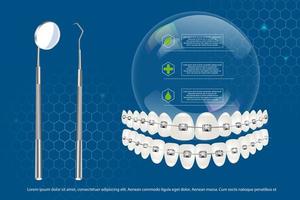 Illustrazione vettoriale 3d, denti realistici con parentesi graffe della mascella superiore e inferiore sullo sfondo di infografiche e strumenti. allineamento del morso dei denti, dentizione con parentesi graffe, apparecchi ortodontici.