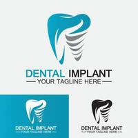 concetto di design vettoriale del logo dell'impianto dentale