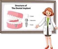 infografica dell'essere umano nella struttura dell'impianto dentale vettore