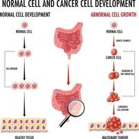 diagramma che mostra la cellula normale e quella cancerosa vettore