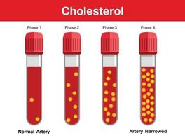 colesterolo nell'arteria, rischio per la salute, disegno vettoriale