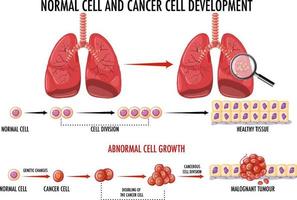 diagramma che mostra la cellula normale e quella cancerosa vettore