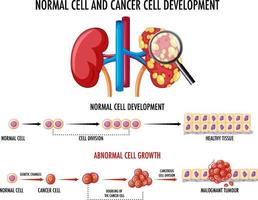 diagramma che mostra la cellula normale e quella cancerosa vettore