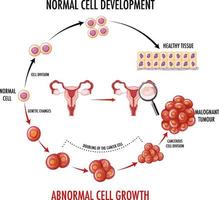 diagramma che mostra il processo di sviluppo del cancro vettore